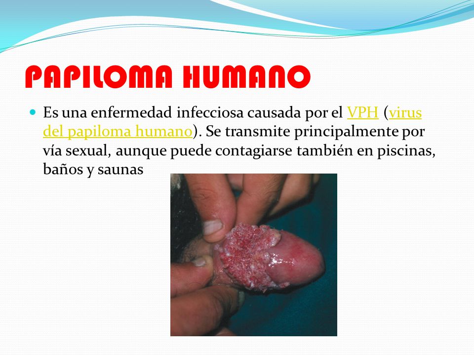 como se transmite el virus de papiloma humano como se transmite el virus de papiloma humano